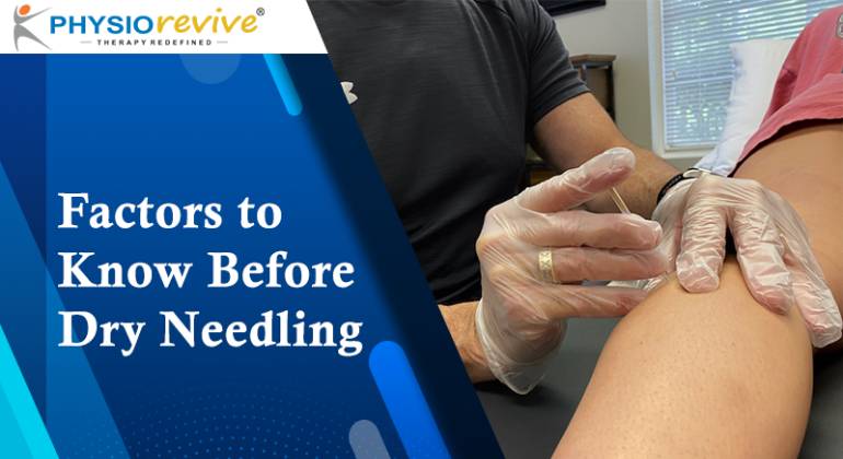 Factors to Know Before Dry Needling