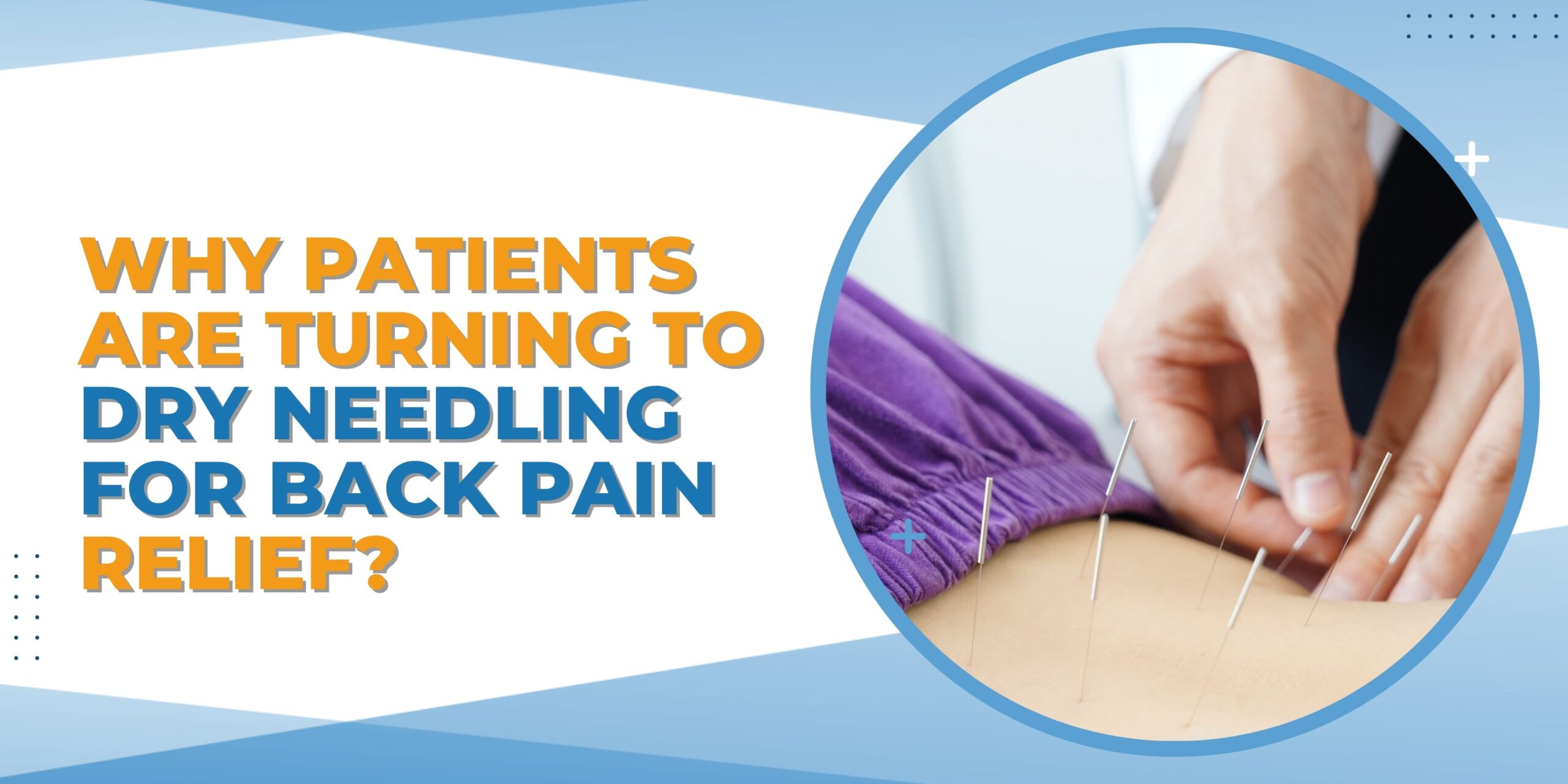 Why Patients Are Turning to Dry Needling for Back Pain Relief?