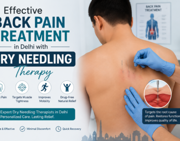 Dry Needling Therapist in Delhi for Back Pain | Physio Revive